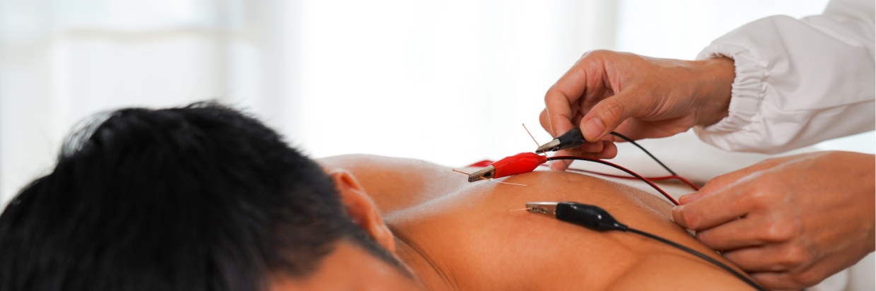 Electroacupuncture