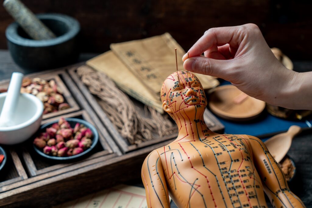 What to Expect After Your Acupuncture Treatment