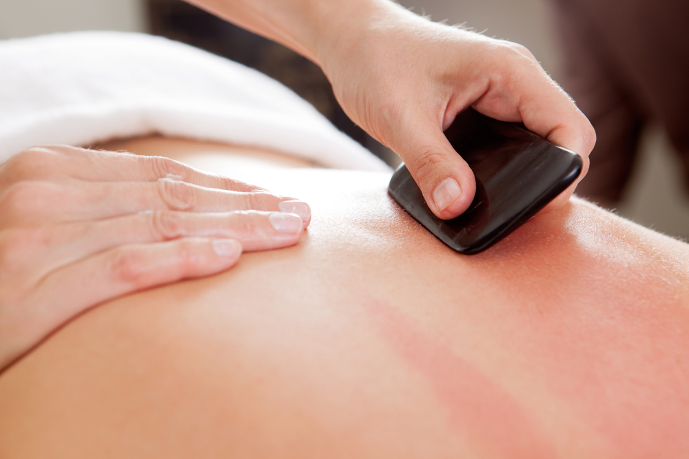 Gua Sha Acupuncture Treatment Explained